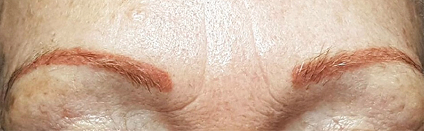 Before image