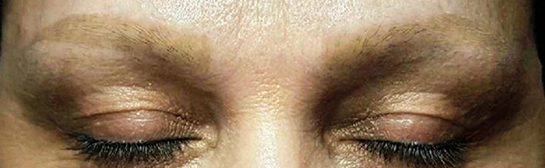 Before image