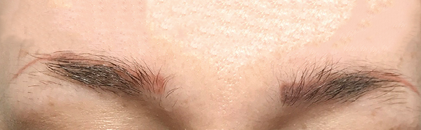 Before image