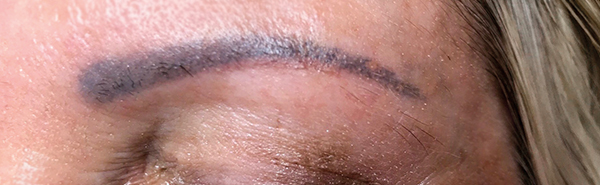 Before image