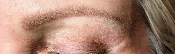 After image