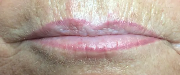 Before image