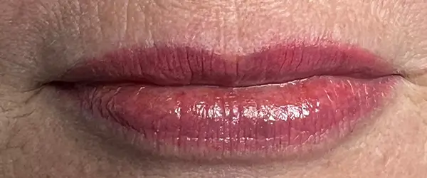 After image