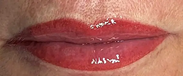 After image