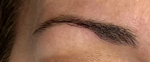 Before image