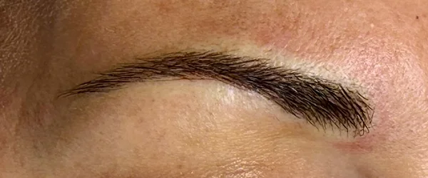 After image